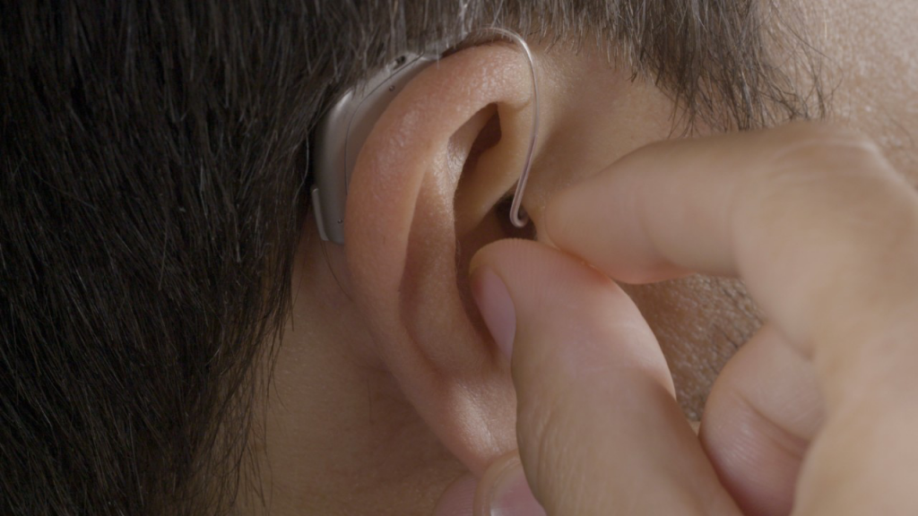 Conductive hearing loss